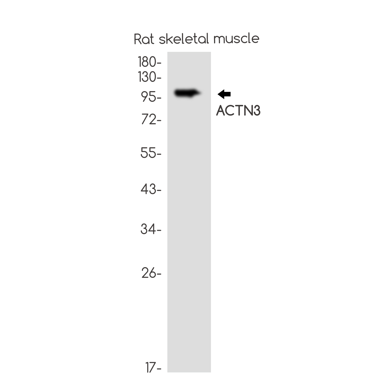 1 - ACTN3 Rabbit mAb AP75034
