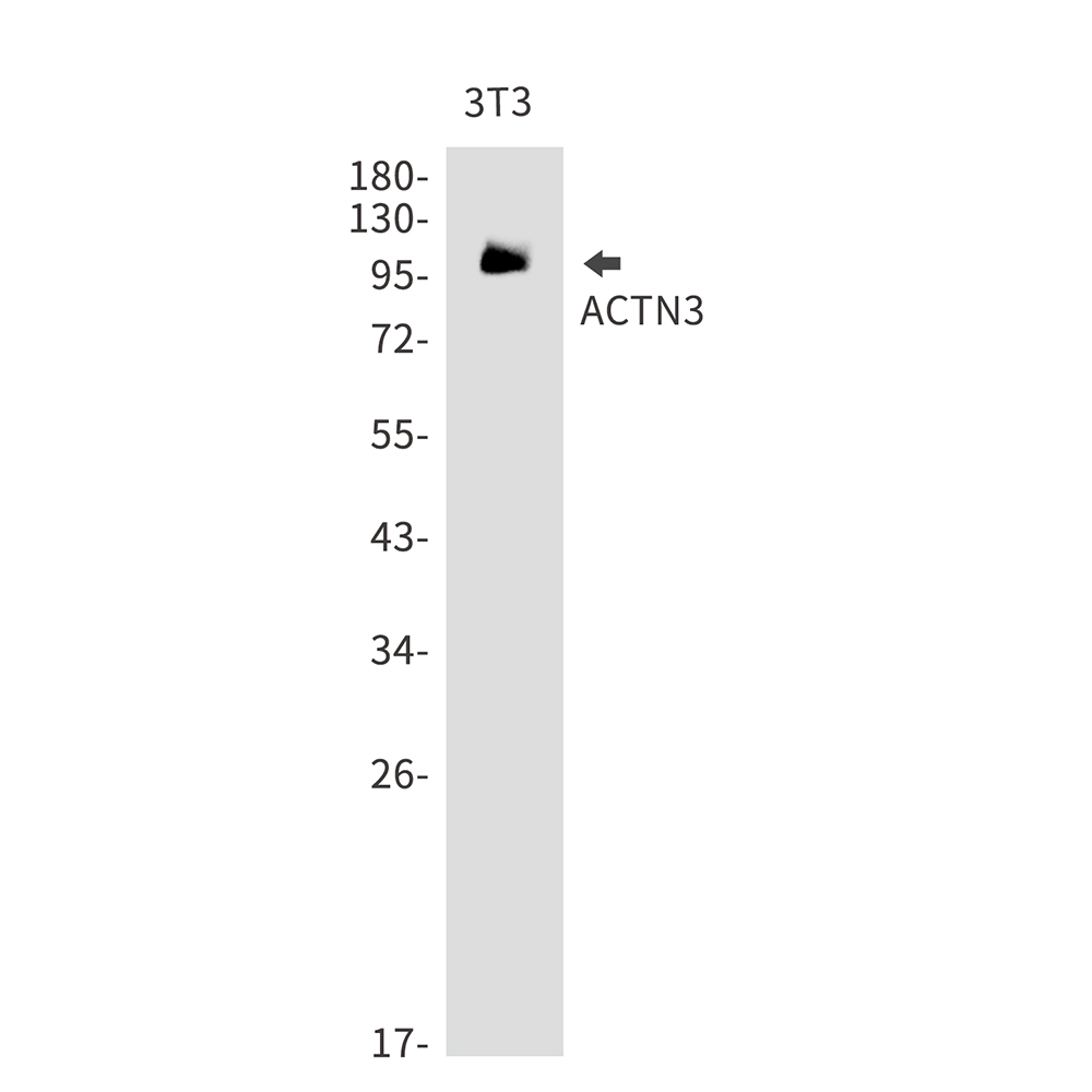 2 - ACTN3 Rabbit mAb AP75034