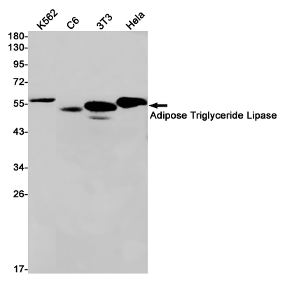 1 - Adipose Triglyceride Lipase Rabbit mAb AP75037