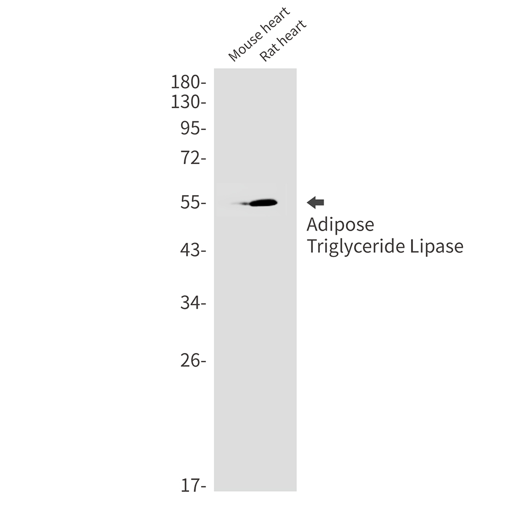 1 - Adipose Triglyceride Lipase Rabbit mAb AP75038