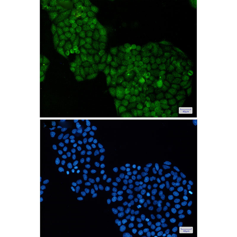 2 - ADRM1/ARM-1 Rabbit mAb AP75040