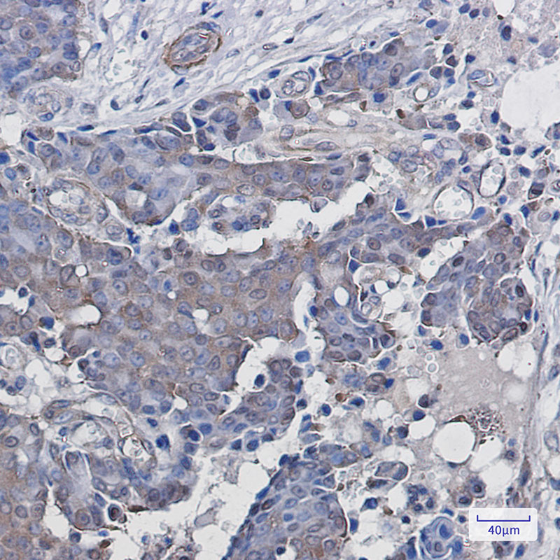 8 - ADRM1/ARM-1 Rabbit mAb AP75040