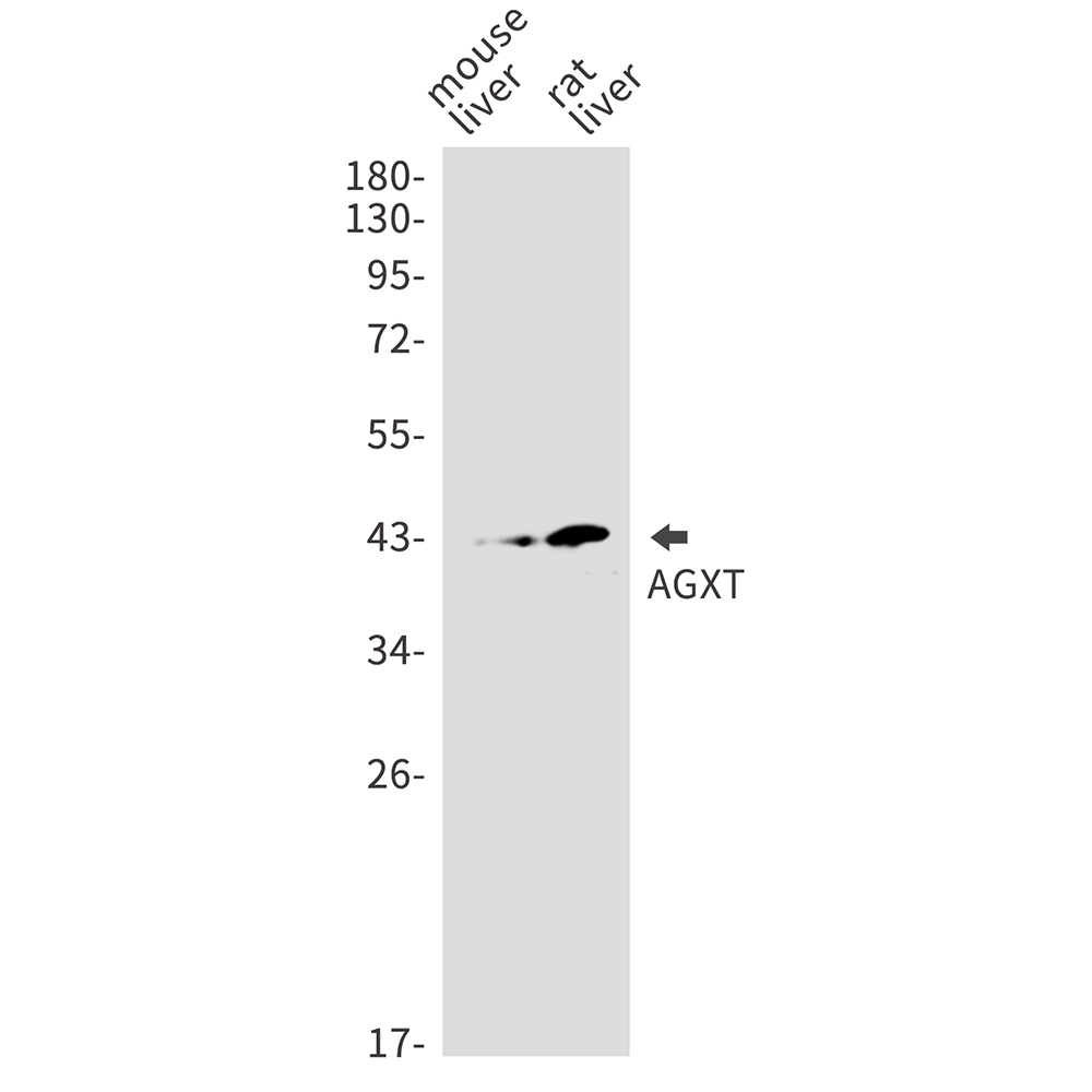 1 - AGXT Rabbit mAb AP75044