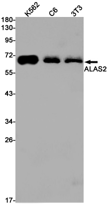 1 - ALAS2/ASB Rabbit mAb AP75047