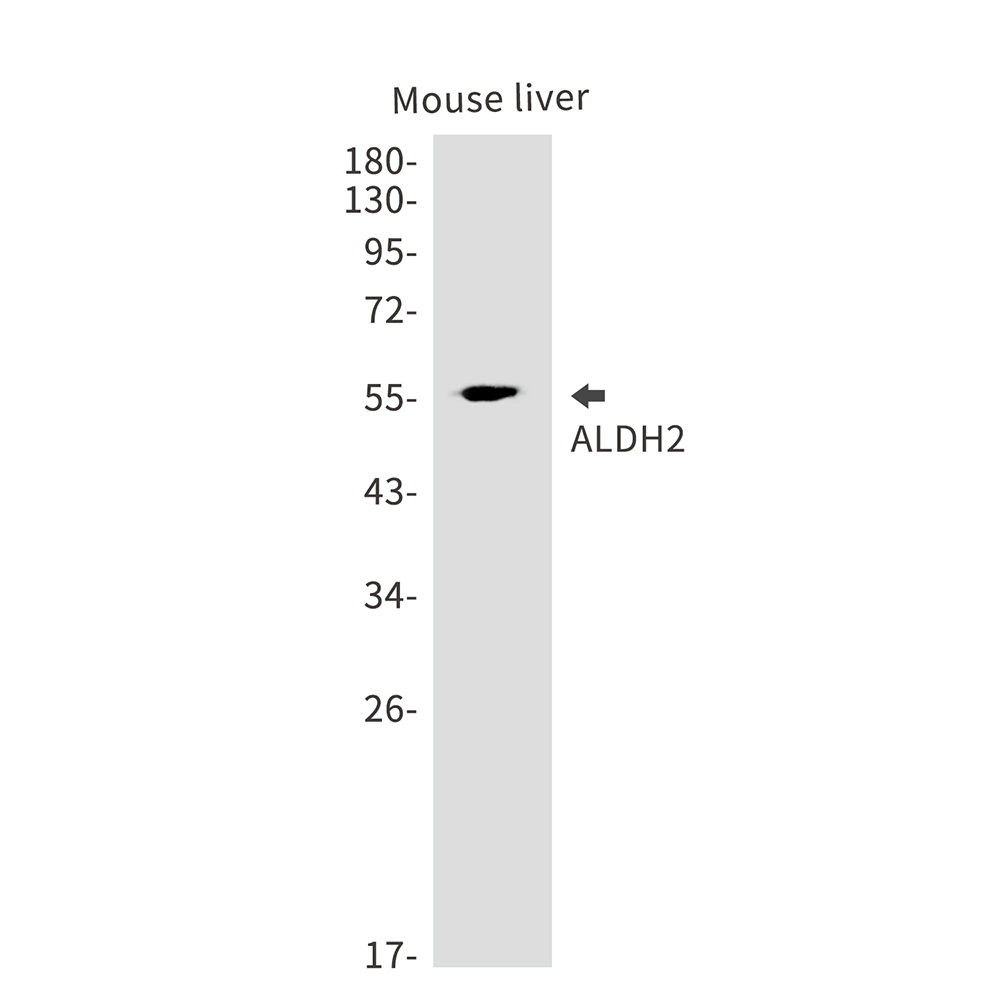 1 - ALDH2 Rabbit mAb AP75049
