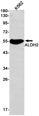 2 - ALDH2 Rabbit mAb AP75049