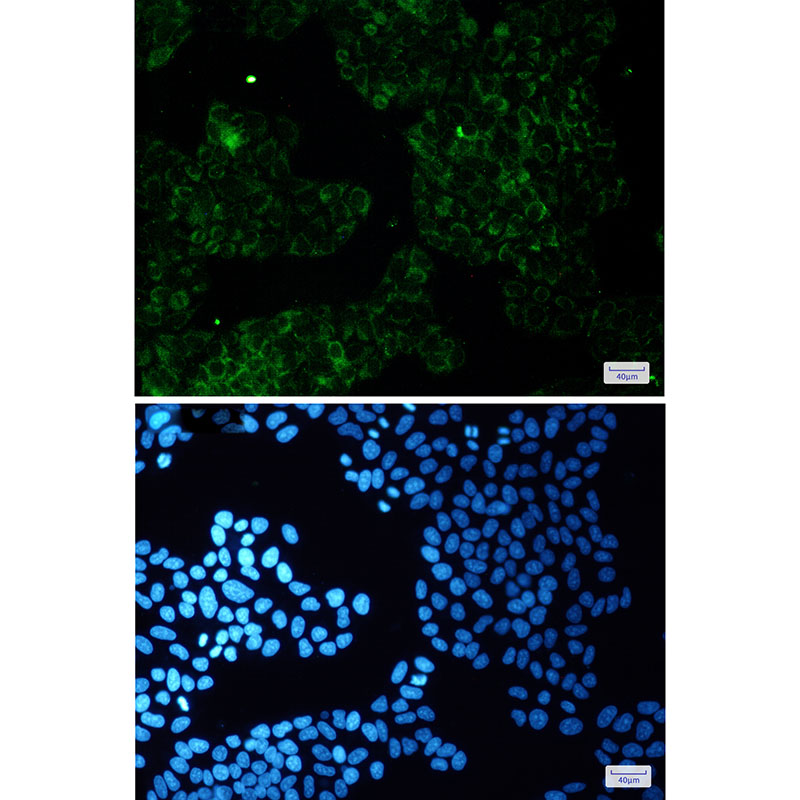 8 - ALDH7A1 Rabbit mAb AP75050