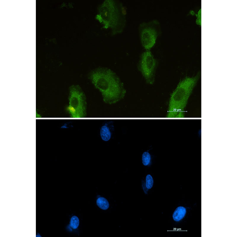 4 - [KO]Aldolase Rabbit mAb AP75051
