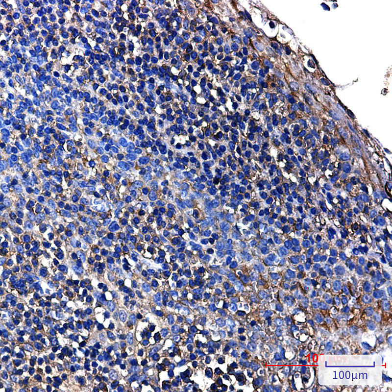 3 - [KO]Aldolase Rabbit mAb AP75051