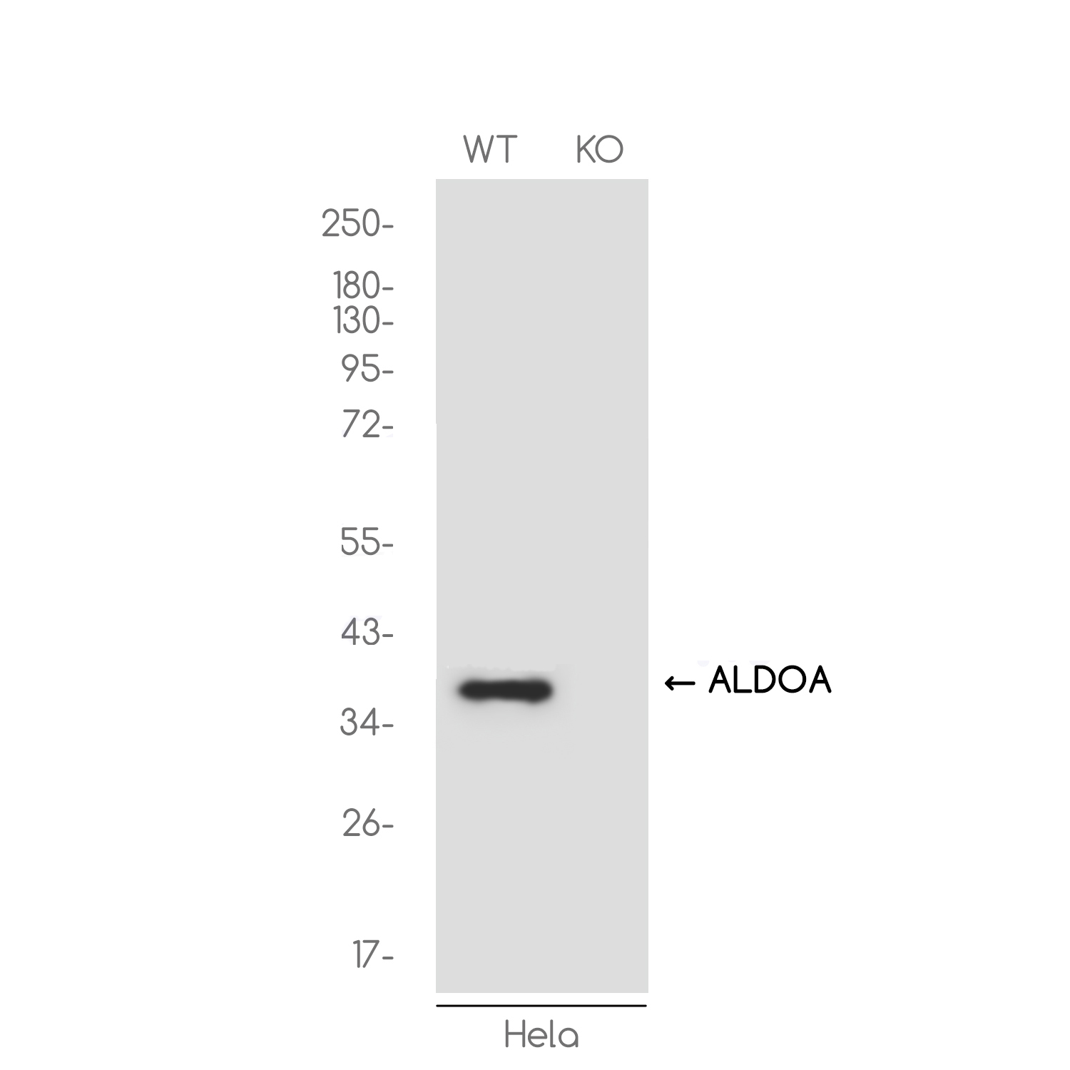 1 - [KO]Aldolase Rabbit mAb AP75051