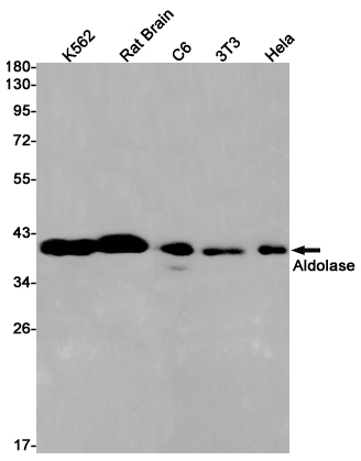 2 - [KO]Aldolase Rabbit mAb AP75051