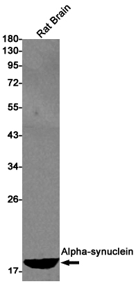 1 - alpha Synuclein Rabbit mAb AP75067
