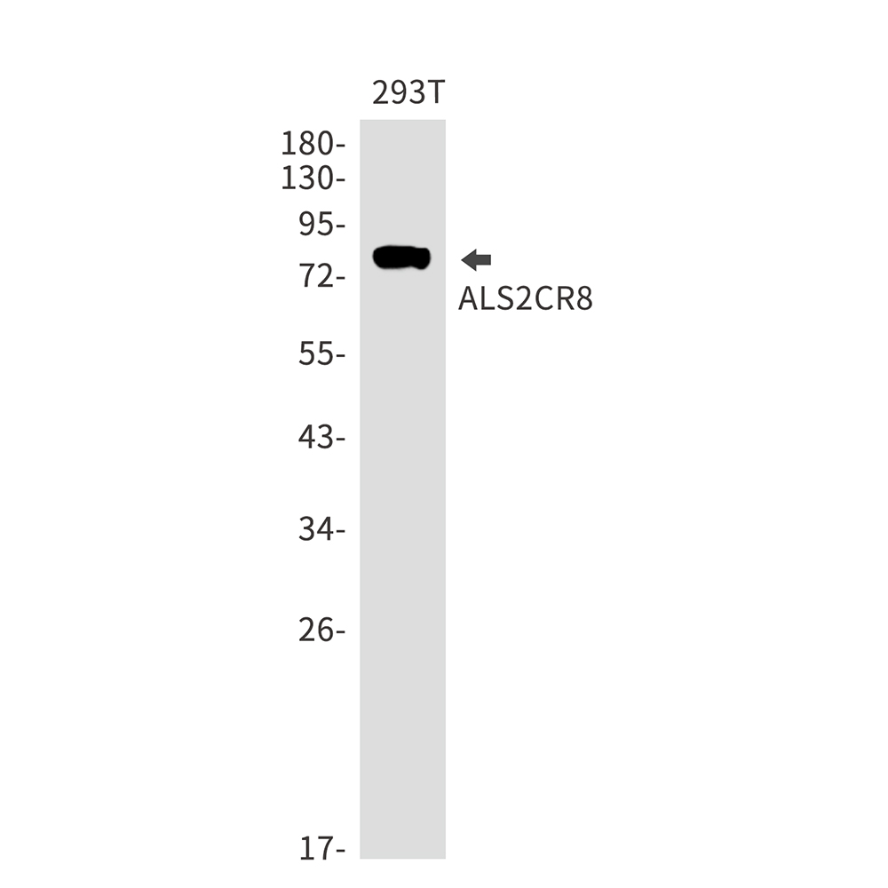 1 - ALS2CR8 Rabbit mAb AP75068