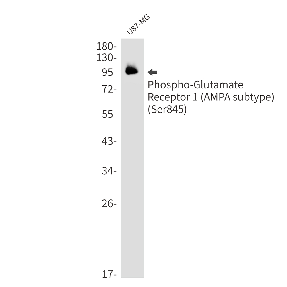 1 - Phospho-Glutamate Receptor 1 (AMPA Subtype) (Ser845) Rabbit mAb AP75070