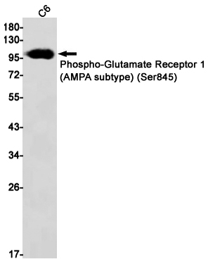 0 - Phospho-Glutamate Receptor 1 (AMPA Subtype) (Ser845) Rabbit mAb AP75070