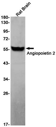 1 - Angiopoietin 2/ANG2 Rabbit mAb AP75073