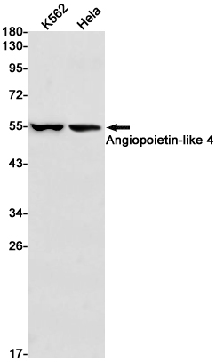 1 - Angiopoietin-like 4/ANGPTL4 Rabbit mAb AP75074
