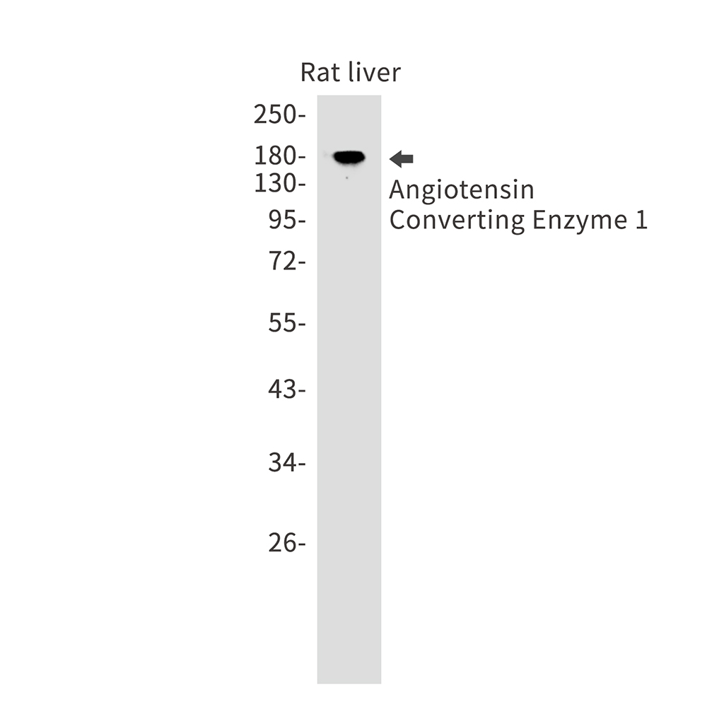 1 - Angiotensin Converting Enzyme 1 Rabbit mAb AP75075