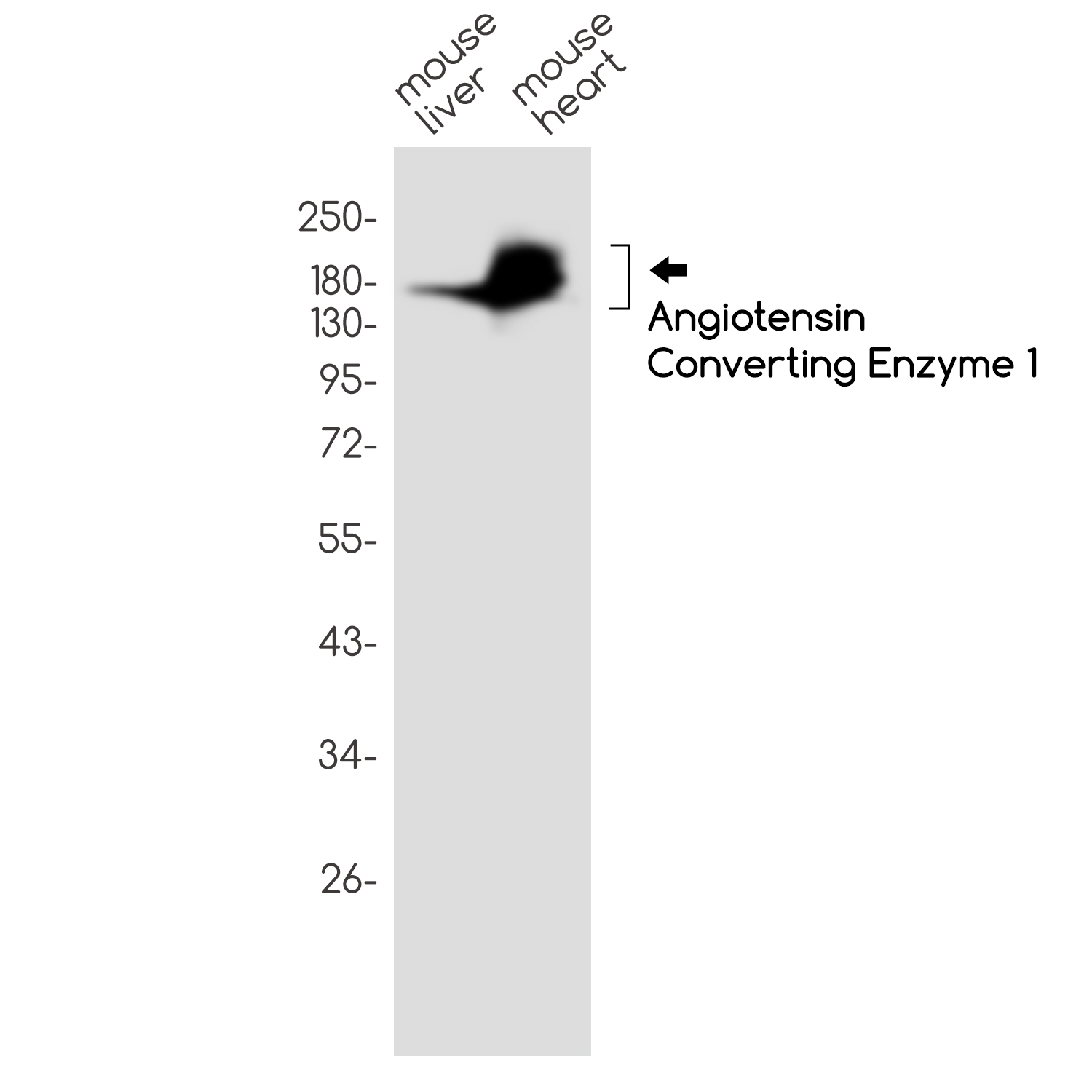 2 - Angiotensin Converting Enzyme 1 Rabbit mAb AP75075