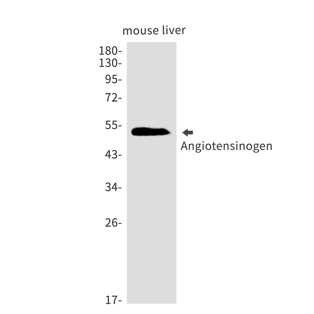 1 - Angiotensinogen Rabbit mAb AP75076