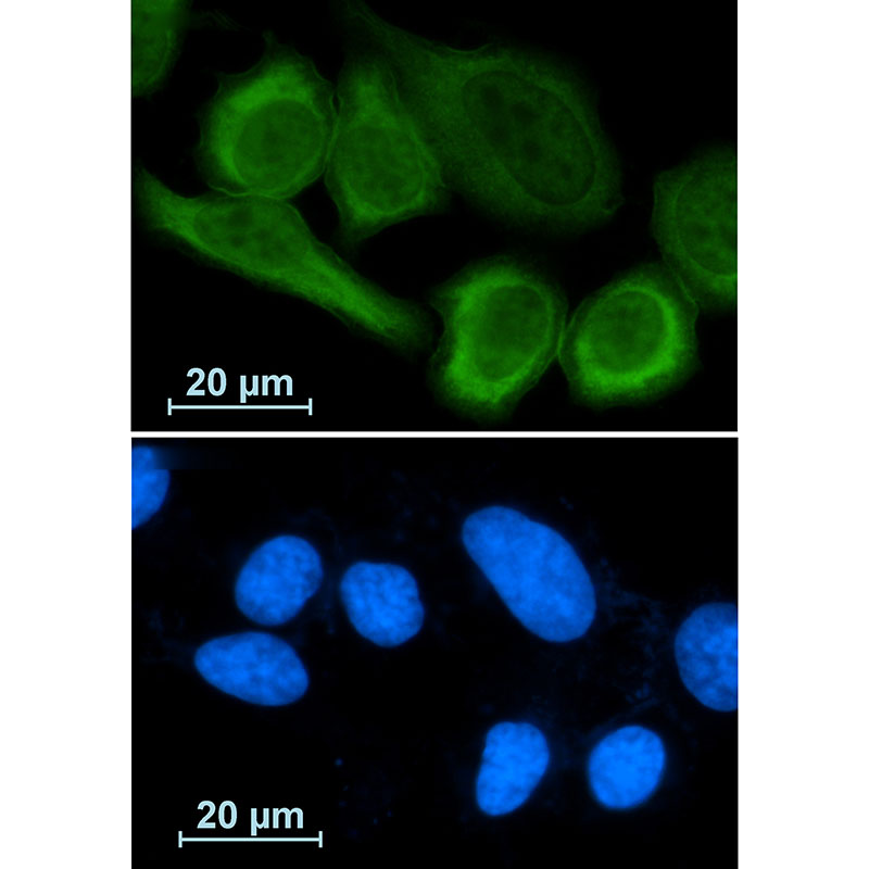 1 - [KD]Annexin A1 Rabbit mAb AP75077