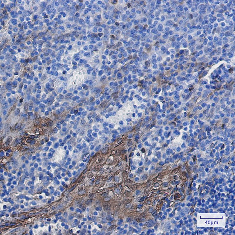 8 - [KD]Annexin A1 Rabbit mAb AP75077
