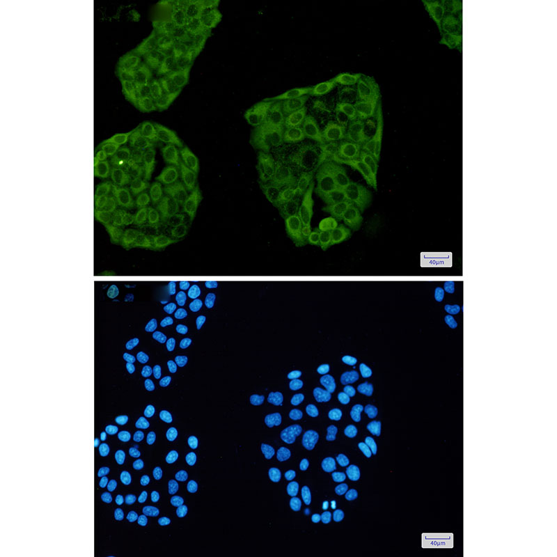 3 - [KD]Annexin VI Rabbit mAb AP75079