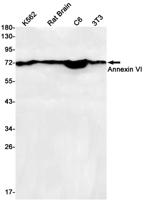 1 - [KD]Annexin VI Rabbit mAb AP75079