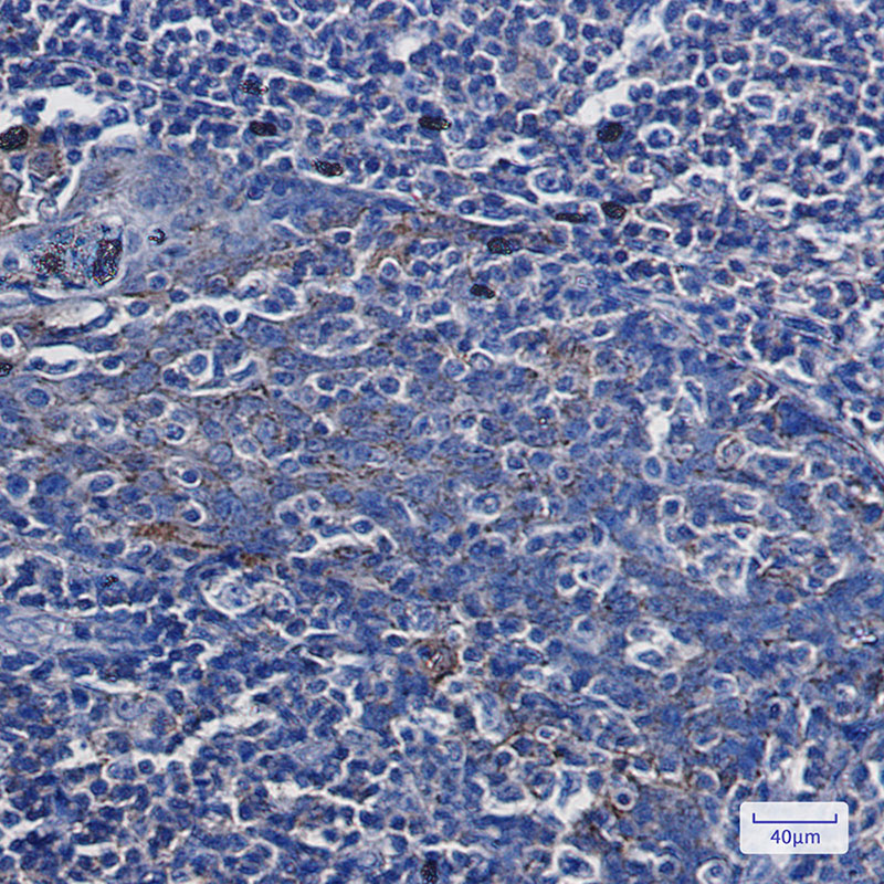 2 - Annexin-7/ANXA7 Rabbit mAb AP75081