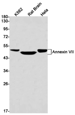1 - Annexin-7/ANXA7 Rabbit mAb AP75081