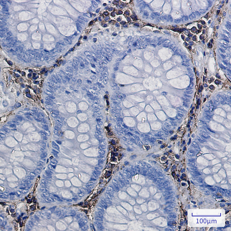 2 - [KO]Annexin VI Rabbit mAb AP75082