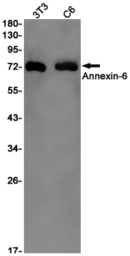 1 - [KO]Annexin VI Rabbit mAb AP75082