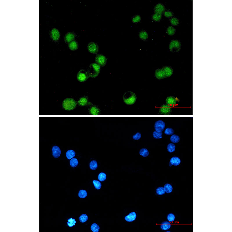 8 - AP2 gamma/TFAP2C Rabbit mAb AP75084