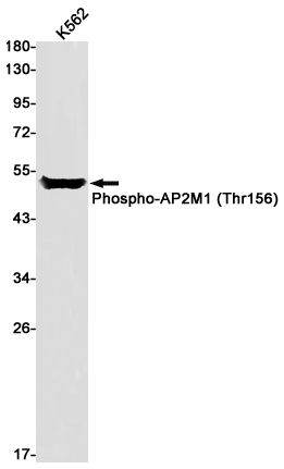 1 - Phospho-AP2M1 (Thr156) Rabbit mAb AP75085
