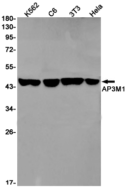 1 - AP3M1 Rabbit mAb AP75086