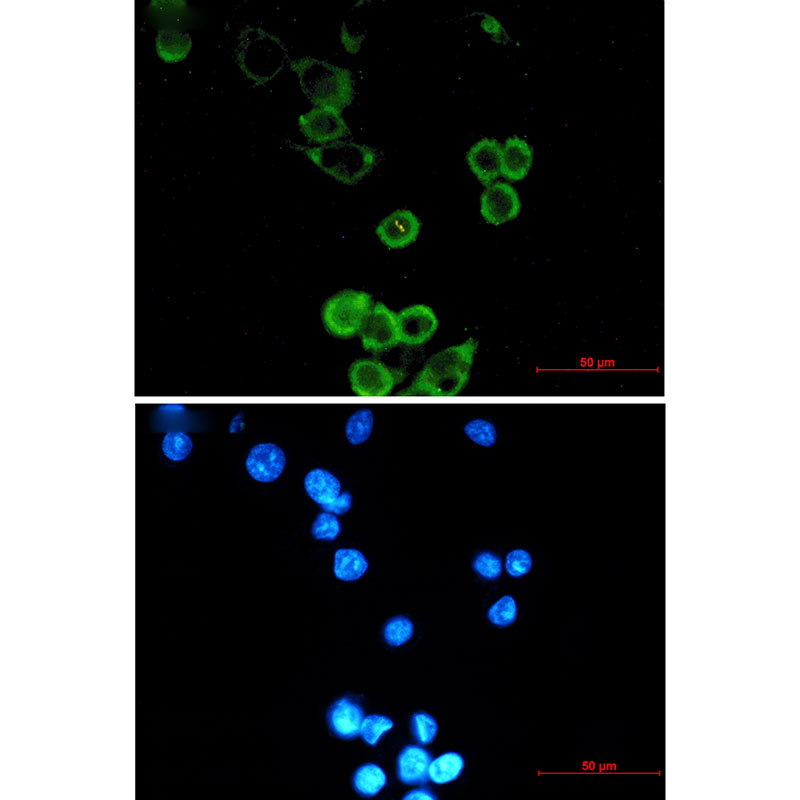 3 - APG5L/ATG5 Rabbit mAb AP75090