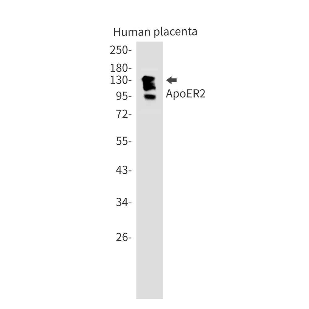 1 - ApoER2 Rabbit mAb AP75092