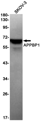 1 - APPBP1 Rabbit mAb AP75093