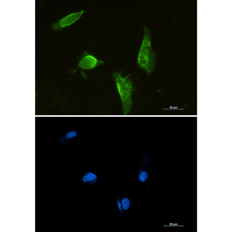 1 - Aprataxin Rabbit mAb AP75095