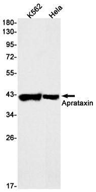 2 - Aprataxin Rabbit mAb AP75095