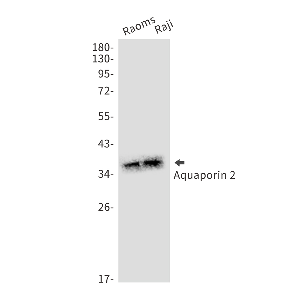1 - Aquaporin 2 Rabbit mAb AP75097