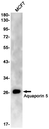 1 - Aquaporin 5 Rabbit mAb AP75098