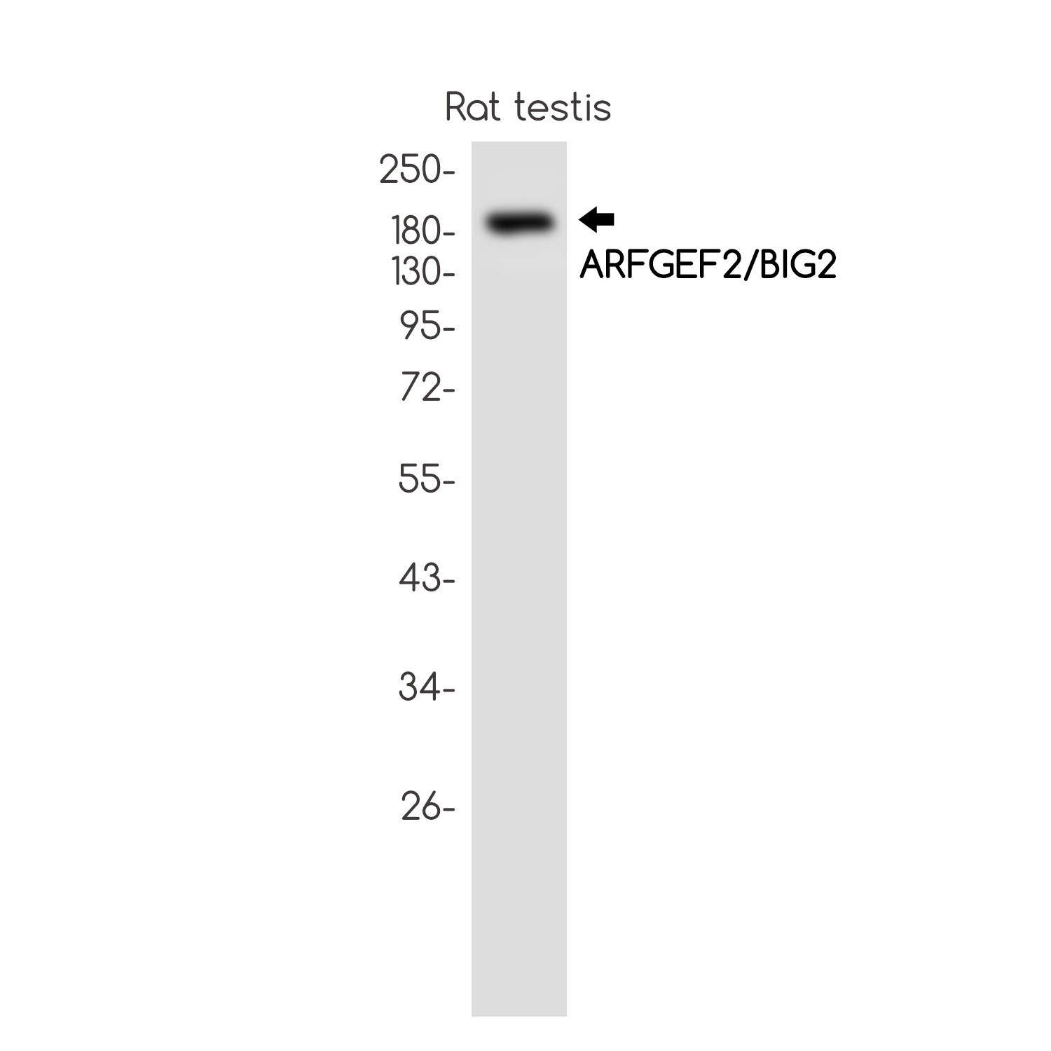 1 - ARFGEF2 Rabbit mAb AP75099