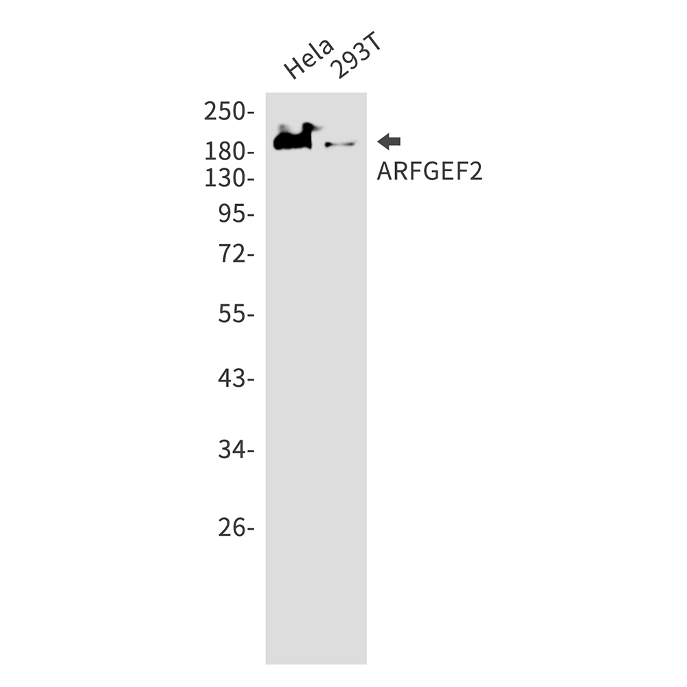 0 - ARFGEF2 Rabbit mAb AP75099
