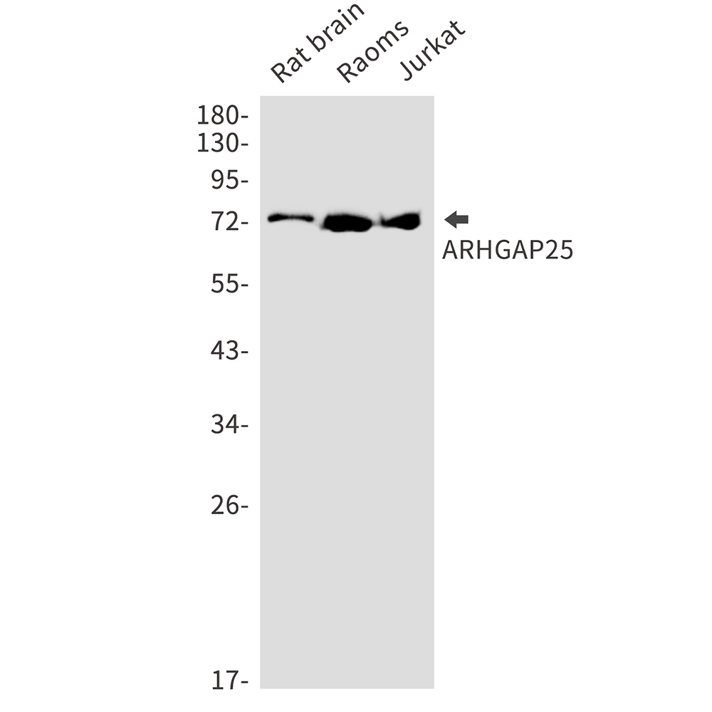 1 - ARHGAP25 Rabbit mAb AP75102