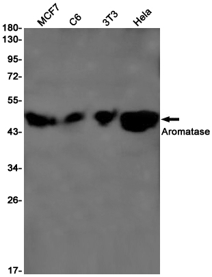 1 - Aromatase Rabbit mAb AP75103