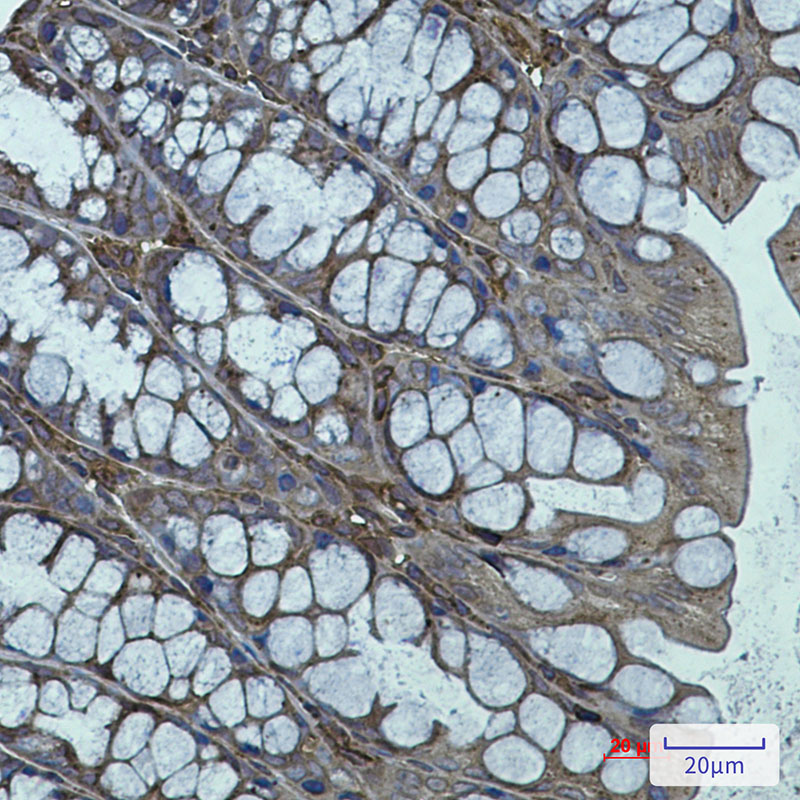 1 - Arp3 Rabbit mAb AP75104