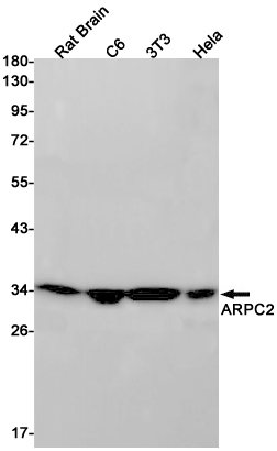 1 - ARPC2 Rabbit mAb AP75105