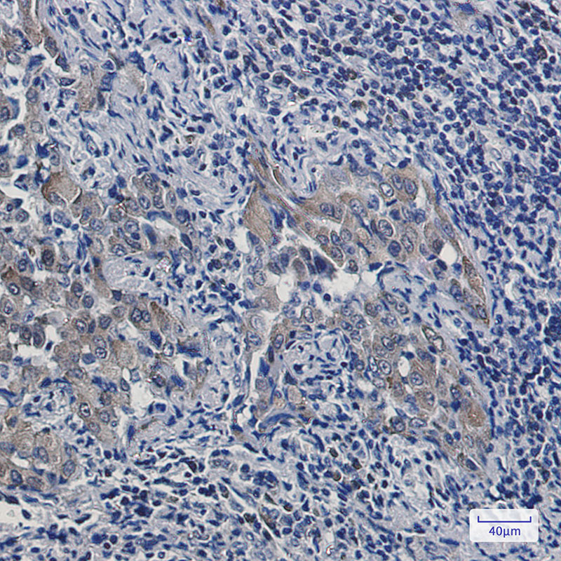 5 - Artemin Rabbit mAb AP75106