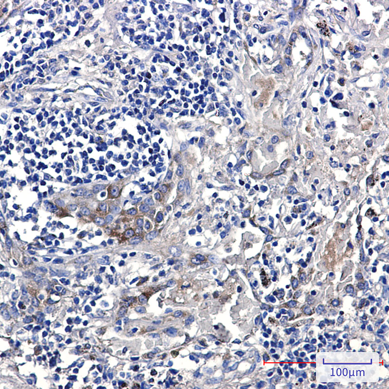 2 - ERAP1 Rabbit mAb AP75107